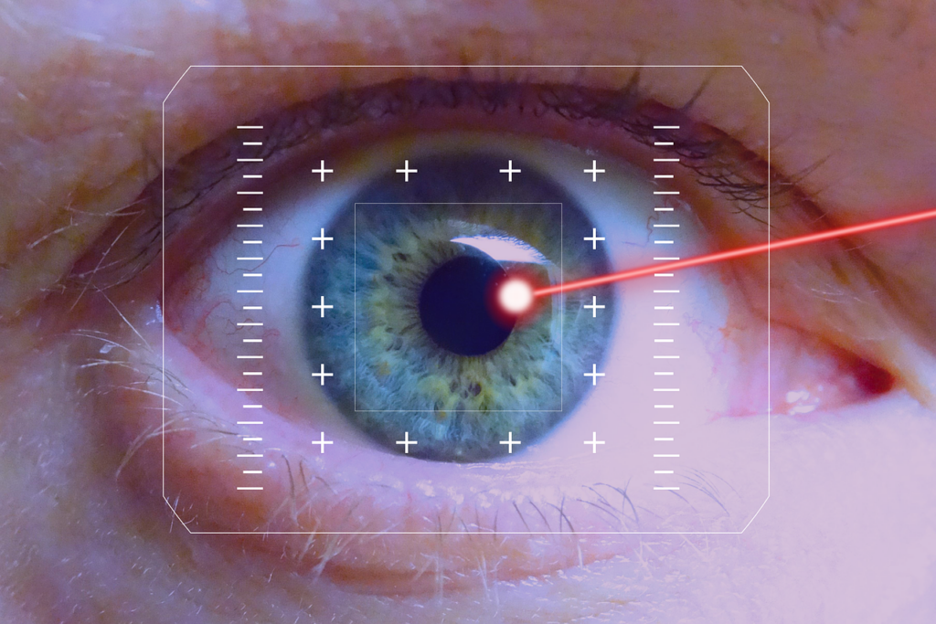 The Benefits and Risks of Eye Surgery LASIK
