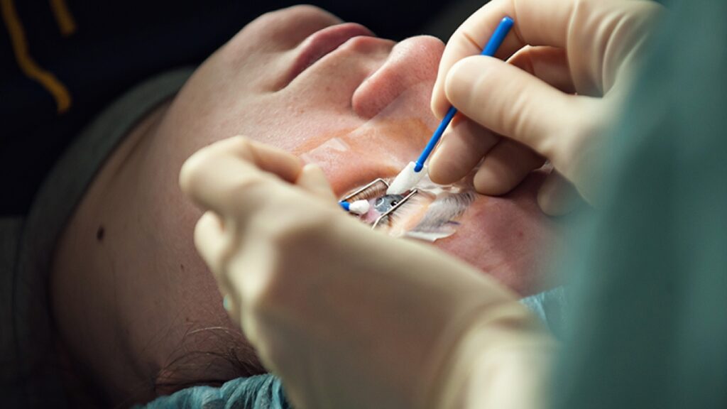 The Benefits and Risks of Eye Surgery LASIK: What You Need to Know